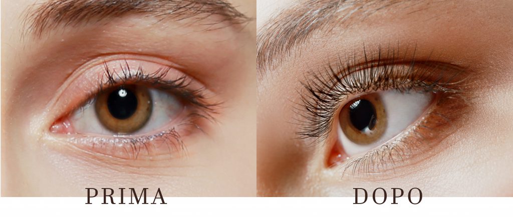 Prima Nanolash Dopo Nanolash